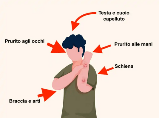 Caso di studio #1: Trattamento della dermatite atopica attraverso il metodo PNEI